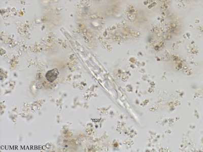 phyto/Bizerte/bizerte_bay/RISCO November 2015/Pleurosigma sp9 (Baie_T1B-Pleurosigma sp3-3).tif(copy)_thumb.jpg